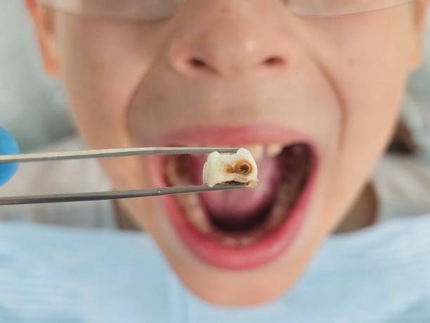Best Orthodontic Emergency Dentist in Avery Creek, NC